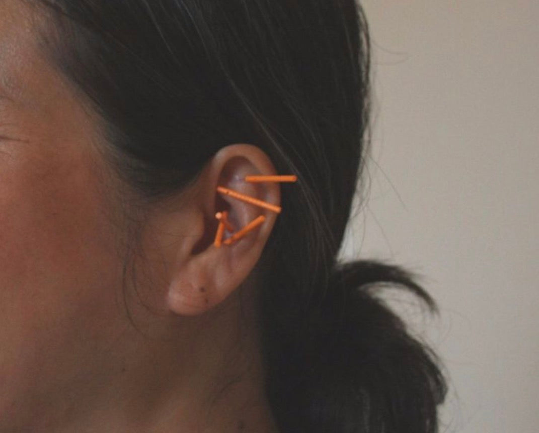 Ear Acupuncture Treatment