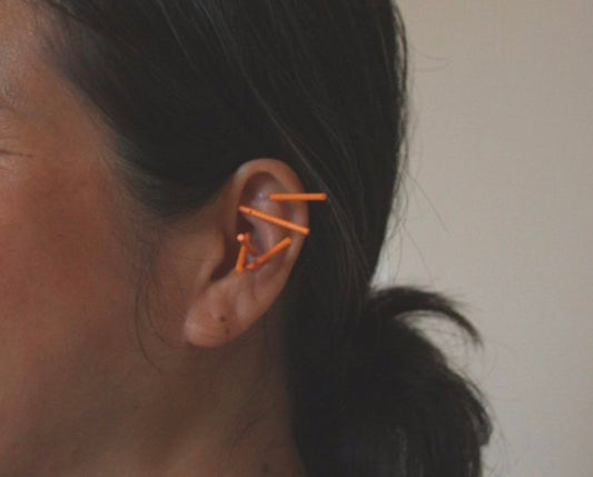 Ear Acupuncture Treatment